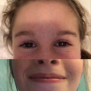 Meet your Posher, Tingling sensation